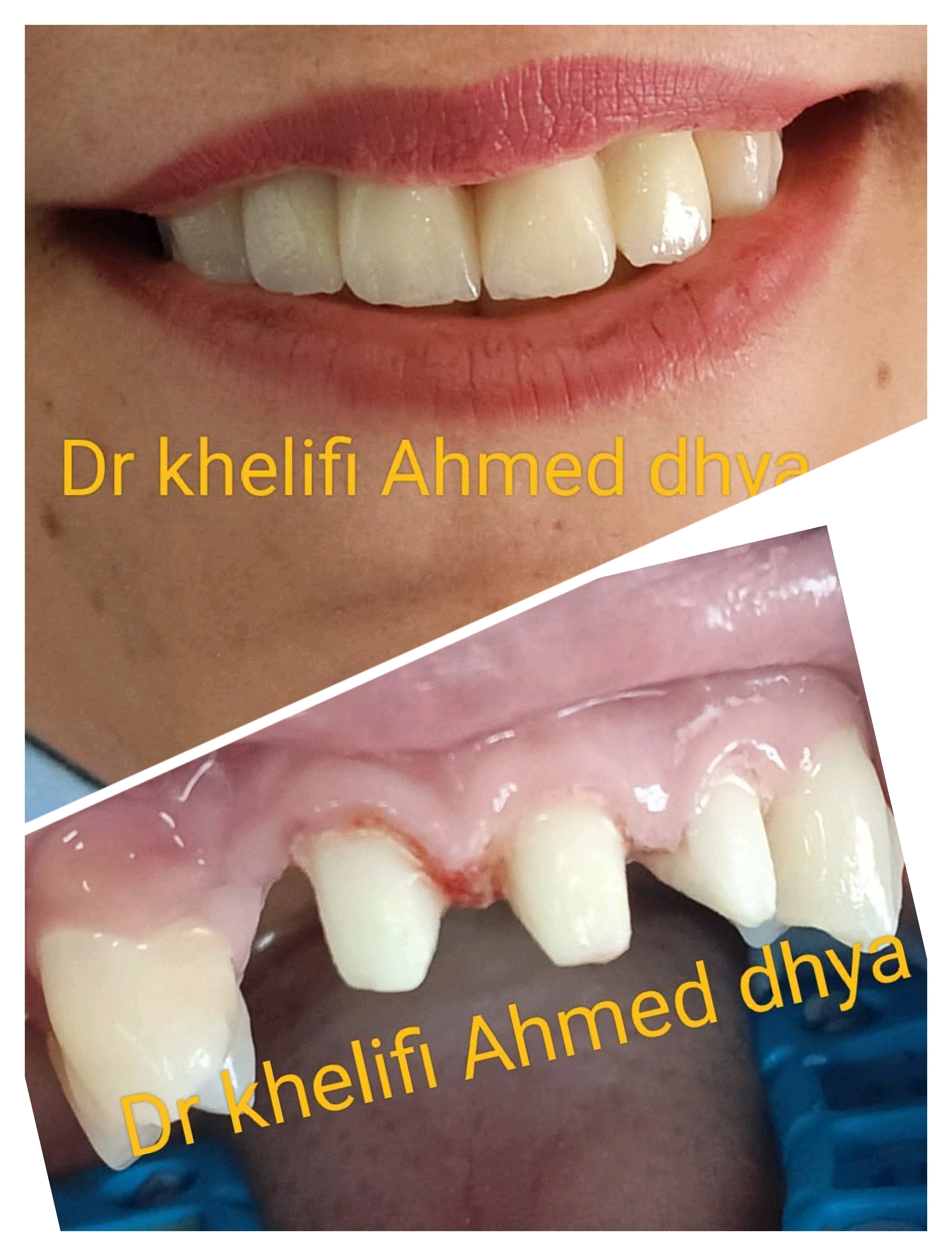 حالة قبل وبعد ١