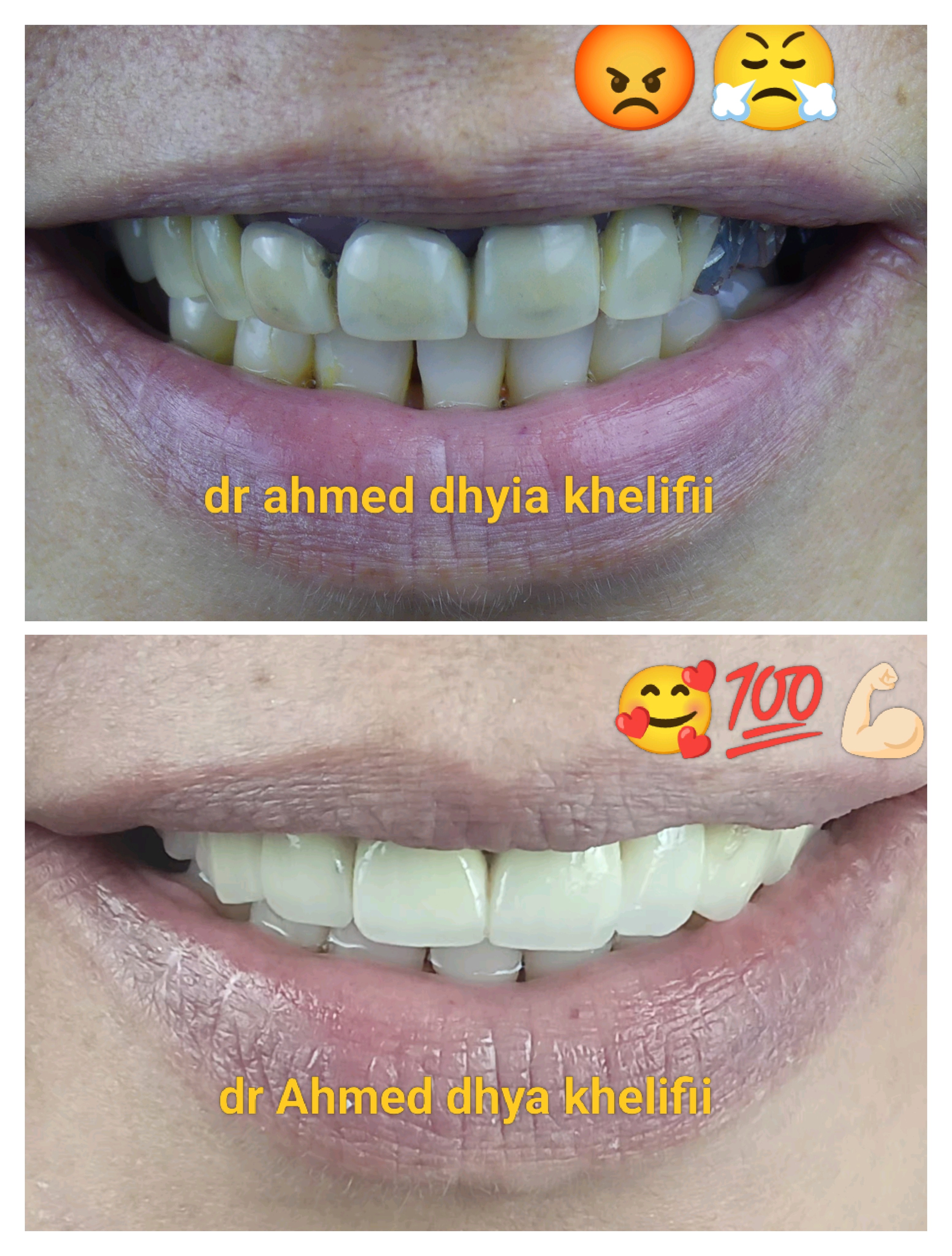 حالة قبل وبعد ٣