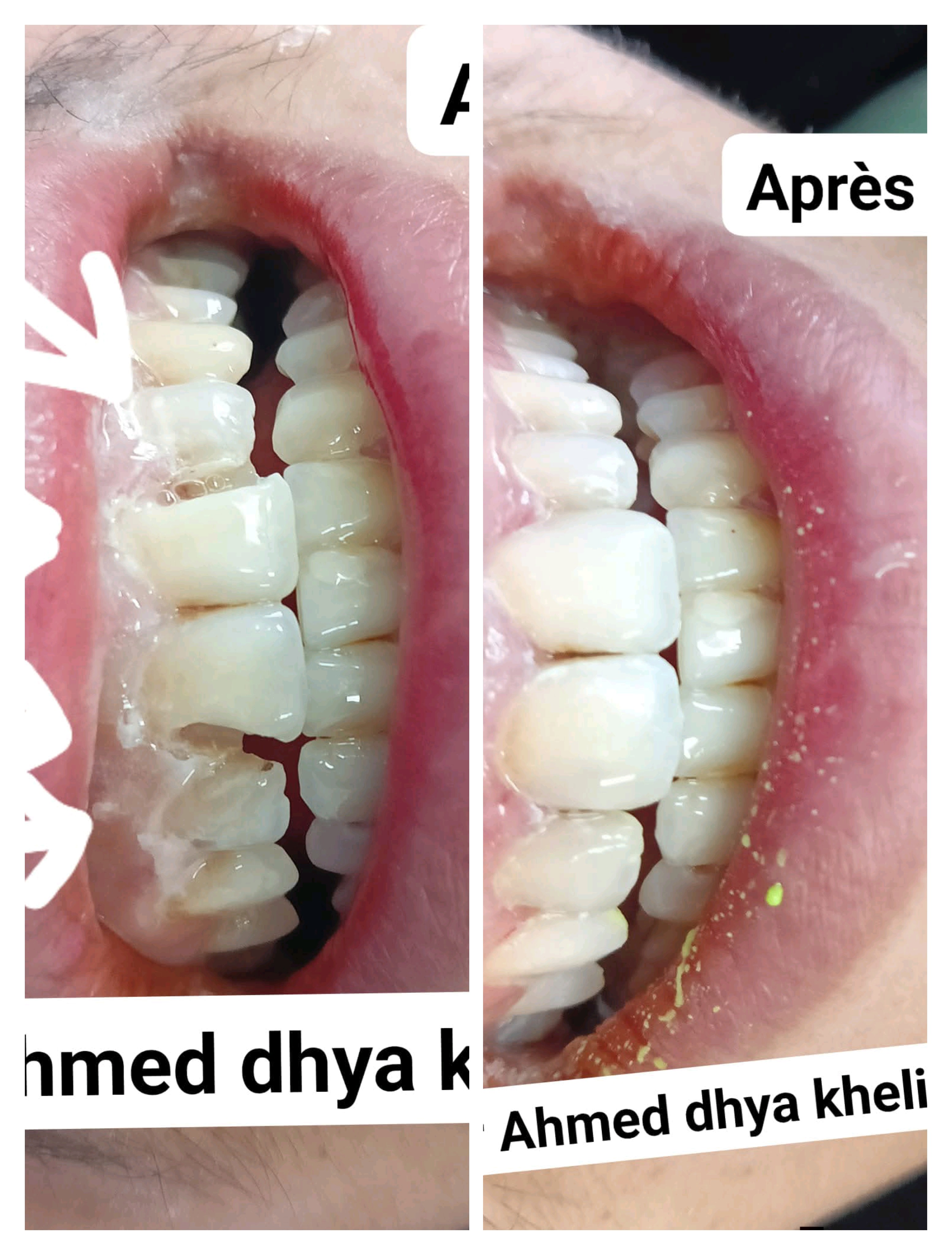 حالة قبل وبعد ٩